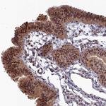 Ubiquitin C Antibody in Immunohistochemistry (Paraffin) (IHC (P))
