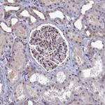 Ubiquitin C Antibody in Immunohistochemistry (Paraffin) (IHC (P))