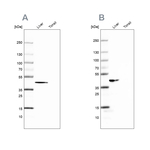 FAH Antibody in Western Blot (WB)