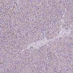 TRAPPC4 Antibody in Immunohistochemistry (Paraffin) (IHC (P))