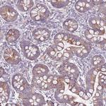 TRAPPC4 Antibody in Immunohistochemistry (Paraffin) (IHC (P))