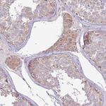 TRAPPC4 Antibody in Immunohistochemistry (Paraffin) (IHC (P))