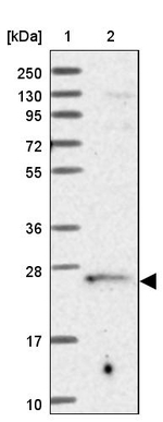 TRAPPC4 Antibody in Western Blot (WB)