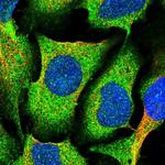 MVD Polyclonal Antibody