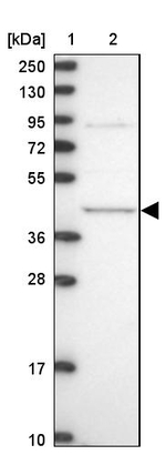 MVD Antibody in Western Blot (WB)