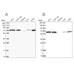 POLR3E Antibody in Western Blot (WB)