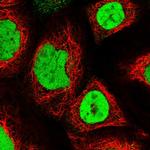 UBA2 Polyclonal Antibody