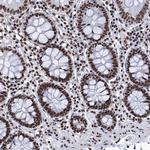 UBA2 Antibody in Immunohistochemistry (Paraffin) (IHC (P))