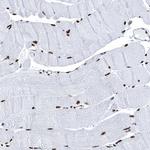 UBA2 Antibody in Immunohistochemistry (Paraffin) (IHC (P))