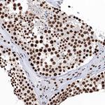 UBA2 Antibody in Immunohistochemistry (Paraffin) (IHC (P))