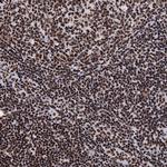 UBA2 Antibody in Immunohistochemistry (Paraffin) (IHC (P))
