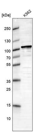UBA2 Antibody in Western Blot (WB)