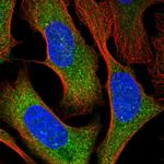 GTPBP9 Polyclonal Antibody