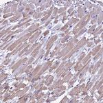 IDH3A Antibody in Immunohistochemistry (Paraffin) (IHC (P))