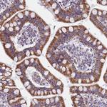 IDH3A Antibody in Immunohistochemistry (Paraffin) (IHC (P))