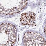 IDH3A Antibody in Immunohistochemistry (Paraffin) (IHC (P))