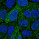 SULT2A1 Polyclonal Antibody