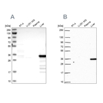 SULT2A1 Antibody in Western Blot (WB)