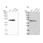 PAICS Antibody in Western Blot (WB)