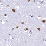 SUGP2 Antibody in Immunohistochemistry (Paraffin) (IHC (P))