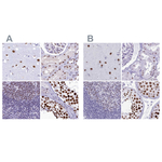 SUGP2 Antibody in Immunohistochemistry (Paraffin) (IHC (P))