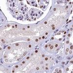 SUGP2 Antibody in Immunohistochemistry (Paraffin) (IHC (P))