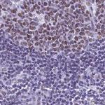 SUGP2 Antibody in Immunohistochemistry (Paraffin) (IHC (P))