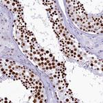 SUGP2 Antibody in Immunohistochemistry (Paraffin) (IHC (P))