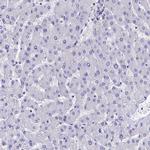 Septin 1 Polyclonal Antibody