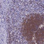 Septin 1 Antibody in Immunohistochemistry (Paraffin) (IHC (P))