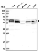 UBAP1 Antibody in Western Blot (WB)