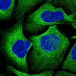 GYS1 Polyclonal Antibody