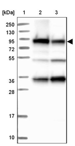 GYS1 Antibody in Western Blot (WB)