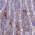 Ferritin Light Chain Antibody in Immunohistochemistry (Paraffin) (IHC (P))