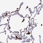 Ferritin Light Chain Antibody in Immunohistochemistry (Paraffin) (IHC (P))
