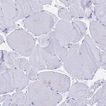 Ferritin Light Chain Antibody in Immunohistochemistry (Paraffin) (IHC (P))