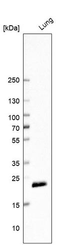 Ferritin Light Chain Antibody in Western Blot (WB)