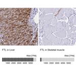 Ferritin Light Chain Antibody