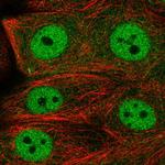 FCHO1 Polyclonal Antibody