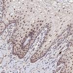 PAF49 Antibody in Immunohistochemistry (Paraffin) (IHC (P))
