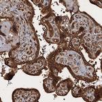 GLE1 Antibody in Immunohistochemistry (Paraffin) (IHC (P))