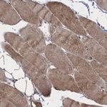 GLE1 Antibody in Immunohistochemistry (Paraffin) (IHC (P))