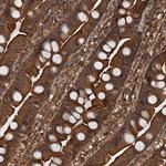 GLE1 Antibody in Immunohistochemistry (Paraffin) (IHC (P))