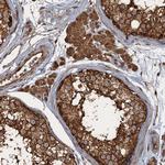 GLE1 Polyclonal Antibody