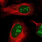 PAF49 Antibody in Immunocytochemistry (ICC/IF)