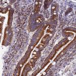 DCI Antibody in Immunohistochemistry (Paraffin) (IHC (P))