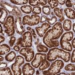 DCI Antibody in Immunohistochemistry (Paraffin) (IHC (P))