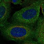 TBC1D2B Polyclonal Antibody