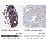 TYROBP Antibody