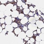 TYROBP Antibody in Immunohistochemistry (Paraffin) (IHC (P))